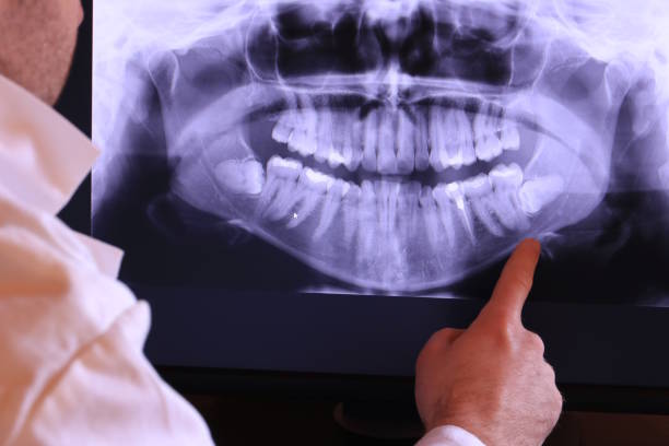 Best Emergency Tooth Extraction in Maywood Park, OR