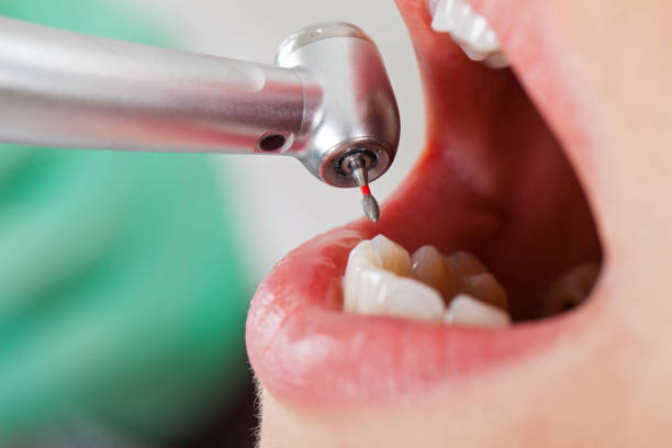 Best Emergency Broken Tooth Repair in Maywood Park, OR